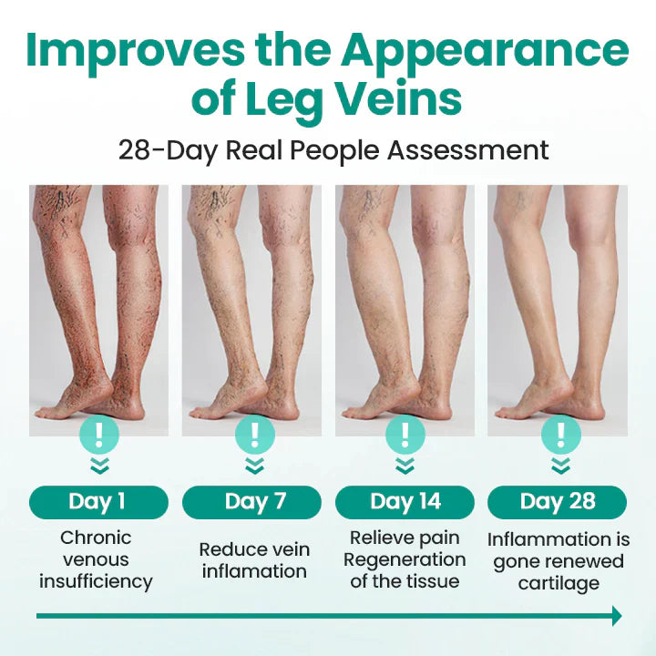 Magnetic Therapy Varicose Veins Patch (PACK OF 100)