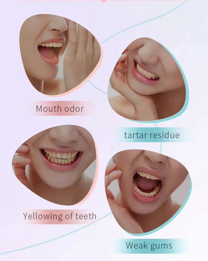 🔥Niacinamide Whitening Toothpaste ( BUY 1 GET 1 FREE ) 🔥