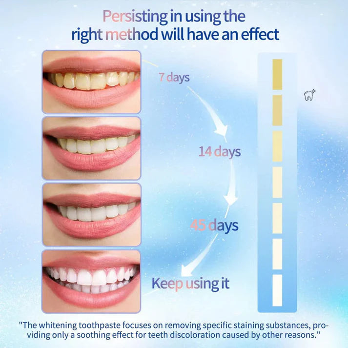 🔥Niacinamide Whitening Toothpaste ( BUY 1 GET 1 FREE ) 🔥
