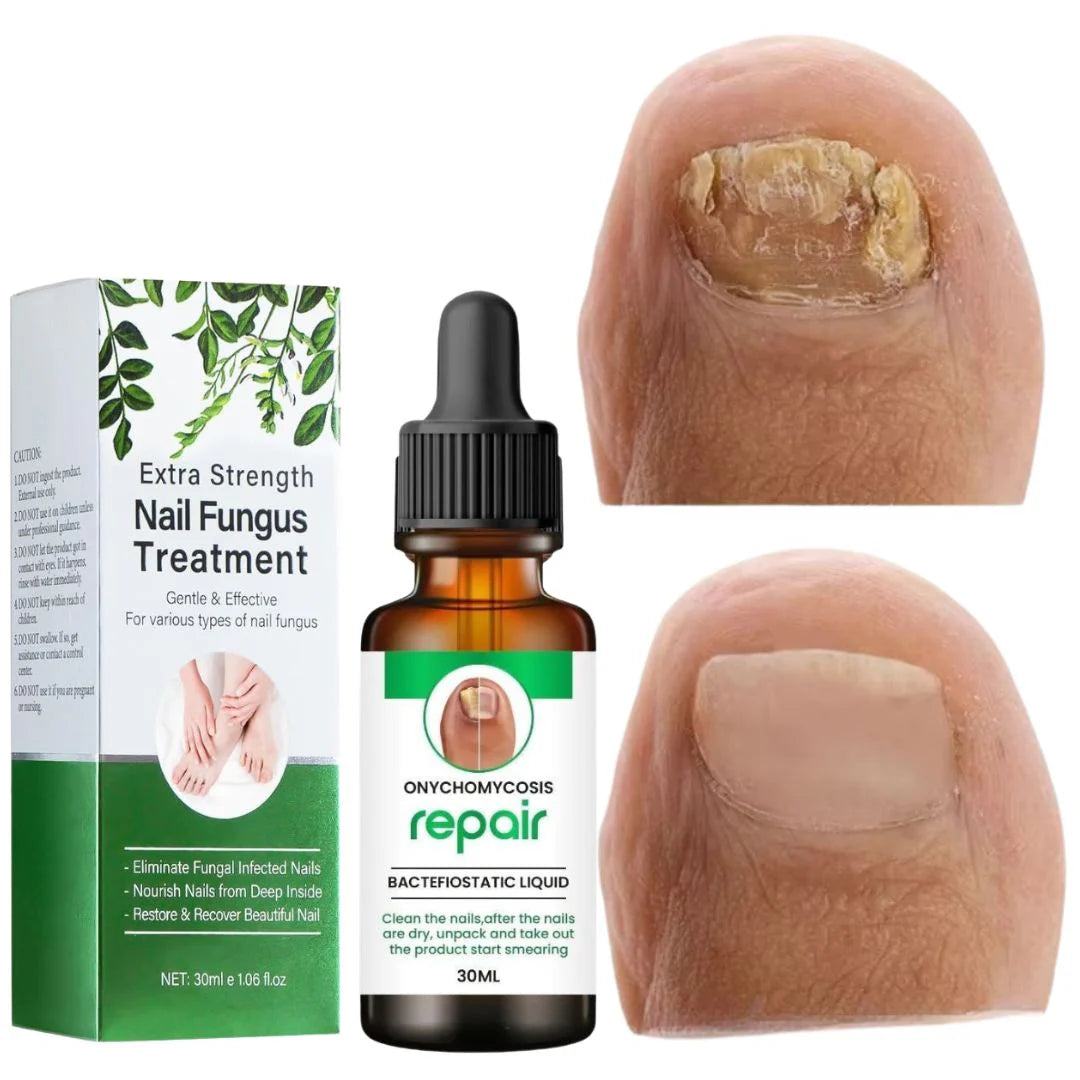 D-More All In One Nail Serum 🔥Doctors 1st Choice 🔥(Top Rated)