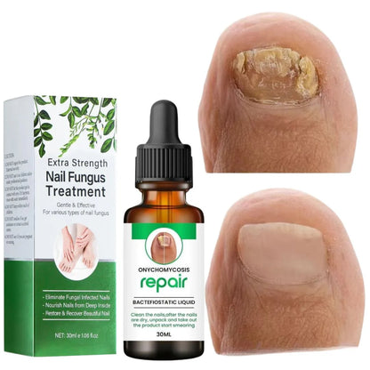 D-More All In One Nail Serum 🔥Doctors 1st Choice 🔥(Top Rated)