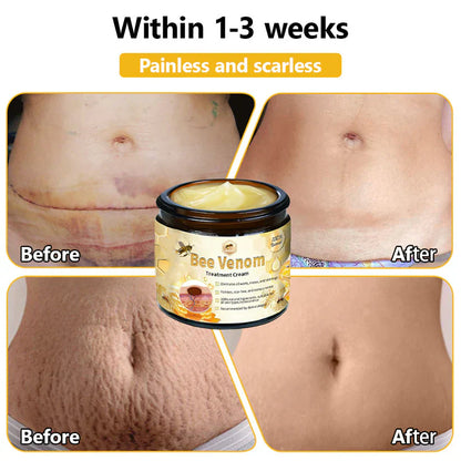 BEE VENOM SKIN TREATMENT CREAM (BUY 1 GET 1 FREE)