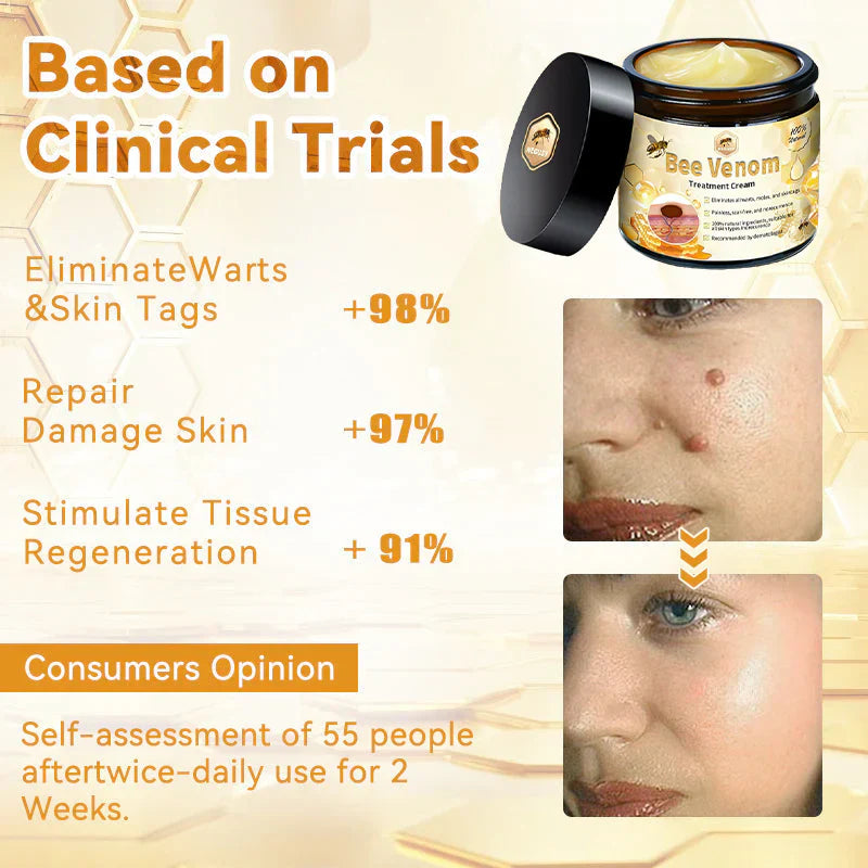 BEE VENOM SKIN TREATMENT CREAM (BUY 1 GET 1 FREE)