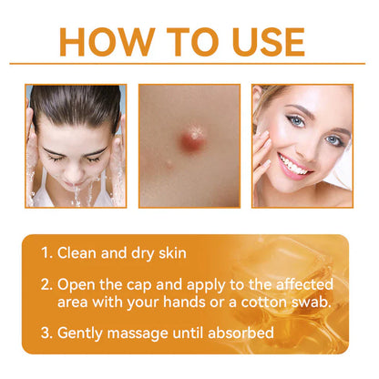 BEE VENOM SKIN TREATMENT CREAM (BUY 1 GET 1 FREE)