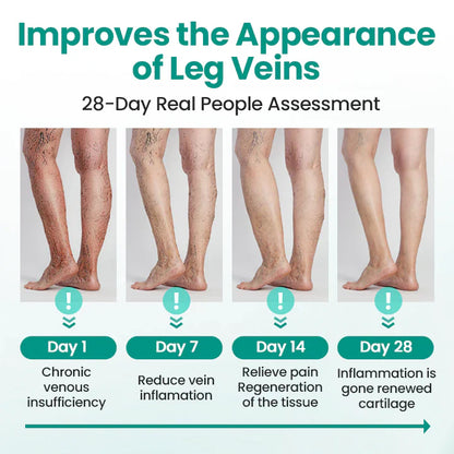 Magnetic Therapy Varicose Veins Patch (PACK OF 100)