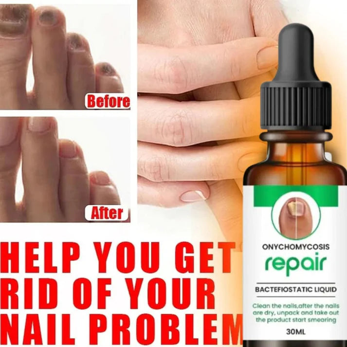 D-More All In One Nail Serum 🔥Doctors 1st Choice 🔥(Top Rated)