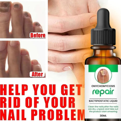 D-More All In One Nail Serum 🔥Doctors 1st Choice 🔥(Top Rated)