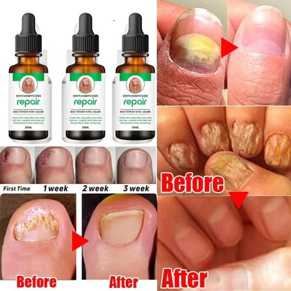 D-More All In One Nail Serum 🔥Doctors 1st Choice 🔥(Top Rated)