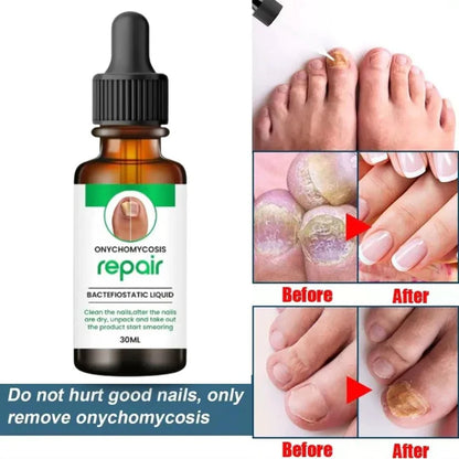 D-More All In One Nail Serum 🔥Doctors 1st Choice 🔥(Top Rated)